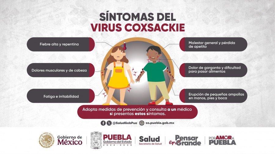 Atiende Gobierno de Puebla brote de virus coxsackie en municipios