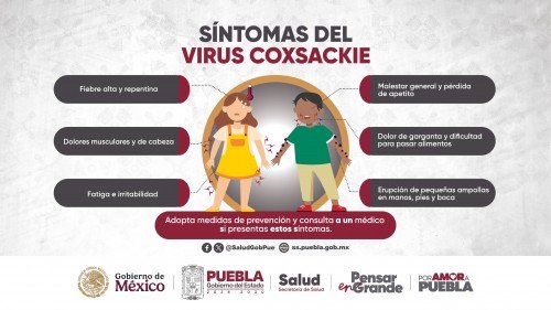 Atiende Gobierno de Puebla brote de virus coxsackie en municipios