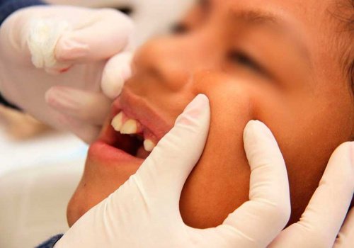 Prevenci&oacute;n de enfermedades dentales inicia en la gestaci&oacute;n con la sana alimentaci&oacute;n de la madre