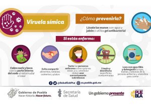 Sin casos sospechosos de viruela símica en Puebla durante 2023: Salud