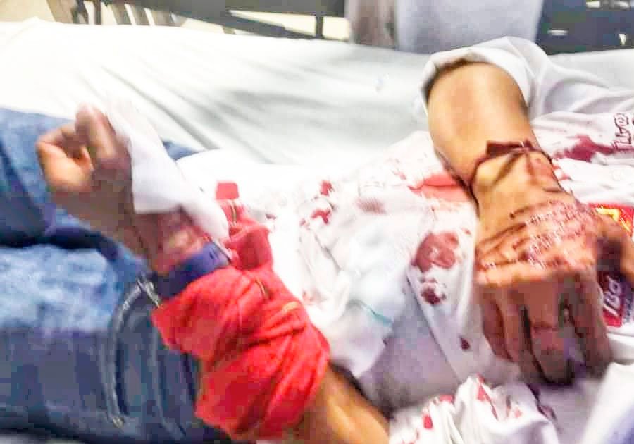 Balean a candidato en Santa Clara Ocoyucan